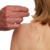Sefton Acupuncture Clinic