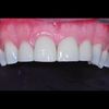 M L S Dental Lab