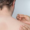 The Acupuncturists