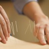 Acu-pro Acupuncture Clinic Within White Arch Clinic