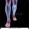 My Foot Fixed