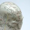 JHS Acupuncture