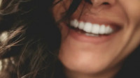 Teeth whitening